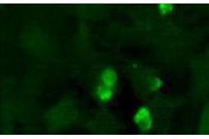 Immunofluorescence (IF) image for anti-Jumonji, AT Rich Interactive Domain 2 (JARID2) (AA 1-100), (N-Term) antibody (ABIN1951845) (JARID2 anticorps  (N-Term))