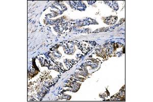 IHC analysis of Prolyl Endopeptidase/PREP using anti-Prolyl Endopeptidase/PREP antibody (ABIN7599118).