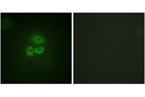 Immunofluorescence analysis of A549 cells, using PKD1/PKC mu (Ab-205) Antibody.