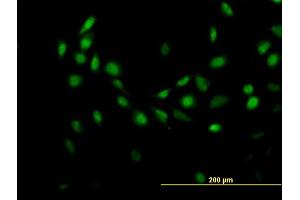 Immunofluorescence of purified MaxPab antibody to C7orf16 on HeLa cell. (G Substrate anticorps  (AA 1-155))
