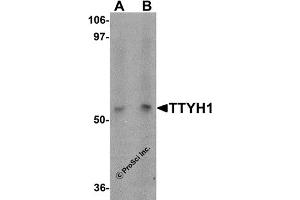 Western Blotting (WB) image for anti-Tweety Homolog 1 (TTYH1) (C-Term) antibody (ABIN1030786) (TTYH1 anticorps  (C-Term))
