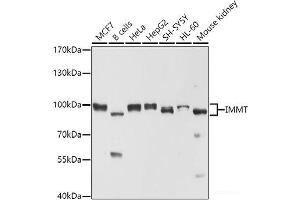 Western blot analysis of extracts of various cell lines using IMMT Polyclonal Antibody at dilution of 1:1000. (IMMT anticorps)