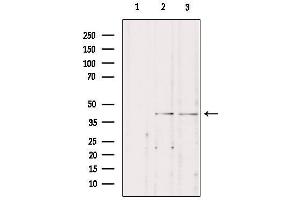 Western blot analysis of extracts from various samples, using STAC3 Antibody.