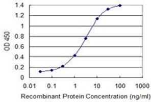 anti-Zinc Finger and BTB Domain Containing 6 (ZBTB6) (AA 121-220) antibody
