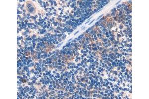 #VALUE! (DNHD1 anticorps  (AA 1-302))