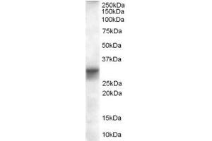 Western Blotting (WB) image for anti-Four and A Half LIM Domains 1 (FHL1) (AA 233-246) antibody (ABIN297027) (FHL1 anticorps  (AA 233-246))