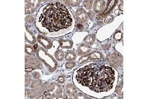 Immunohistochemical staining of human kidney with LDLRAD2 polyclonal antibody  shows distinct cytoplasmic and membranous positivity in cells in glomeruli at 1:200-1:500 dilution. (LDLRAD2 anticorps)