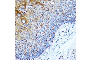 Immunohistochemistry of paraffin-embedded Human esophageal using WWC1 Rabbit pAb (ABIN7271388) at dilution of 1:100 (40x lens). (WWC1 anticorps  (AA 950-1050))