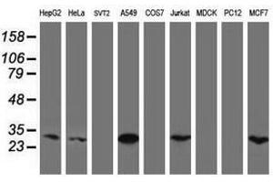 Image no. 4 for anti-Mitochondrial Translational Initiation Factor 3 (MTIF3) (AA 56-278) antibody (ABIN1491591) (MTIF3 anticorps  (AA 56-278))