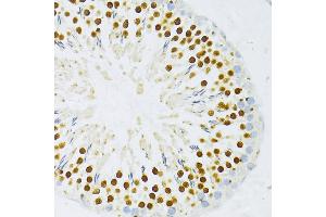 Immunohistochemistry of paraffin-embedded rat testis using DP1/DP1/TFDP1 antibody (ABIN7270892) at dilution of 1:100 (40x lens).