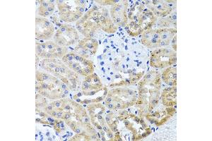 Immunohistochemistry of paraffin-embedded rat kidney using HDAC6 antibody (ABIN1872957) at dilution of 1:100 (40x lens). (HDAC6 anticorps)