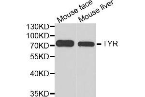 Western blot analysis of extracts of mouse face and mouse liver  tissues, using TYR antibody. (TYR anticorps)