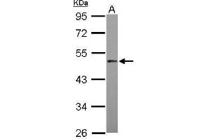 WB Image Sample (30 ug of whole cell lysate) A: HepG2 10% SDS PAGE antibody diluted at 1:1000 (MAPKAP Kinase 5 anticorps)