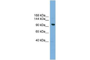 WB Suggested Anti-VPS41 Antibody Titration: 0. (VPS41 anticorps  (Middle Region))