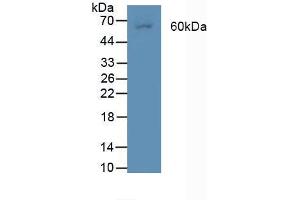 Figure. (BMPR2 anticorps  (AA 27-150))