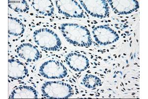 Immunohistochemical staining of paraffin-embedded Kidney tissue using anti-CHEK2mouse monoclonal antibody. (CHEK2 anticorps)