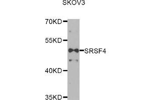 Western blot analysis of extracts of SKOV3 cells, using SRSF4 antibody (ABIN5974197) at 1/1000 dilution. (SRSF4 anticorps)