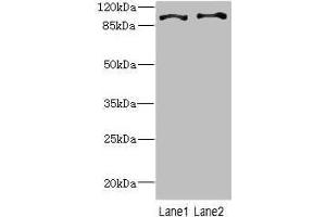 Western blot All lanes: CCP110 antibody at 4. (CP110 anticorps  (AA 1-280))