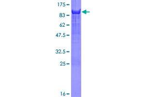 Image no. 1 for Yes-Associated Protein 1 (YAP1) (AA 1-504) protein (GST tag) (ABIN1325497)