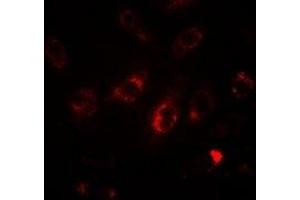 Immunofluorescent analysis of LC3A staining in HepG2 cells. (MAP1LC3A anticorps)