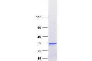 Validation with Western Blot
