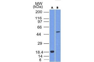 Western Blot Analysis of SOX10 (A) Recombinant protein (B) A375 cell lysate using SOX10 Mouse Monoclonal Antibody (SOX10/992).