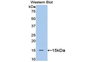 Western blot analysis of the recombinant protein. (Betacellulin anticorps  (AA 32-118))