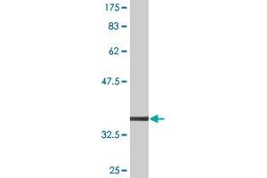 Western Blot detection against Immunogen (37.