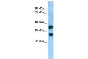 Host:  Rabbit  Target Name:  Aqp8  Sample Type:  Rat Small Intestine lysates  Antibody Dilution:  1. (Aquaporin 8 anticorps  (Middle Region))