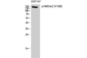 Western Blotting (WB) image for anti-NMDA epsilon 2 (pTyr1336) antibody (ABIN3182688) (NMDA epsilon 2 (pTyr1336) anticorps)