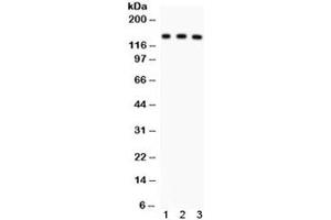 Western blot testing of 1) rat liver, 2) mouse liver and 3) human SMMC lysate with ABCB11 antibody.
