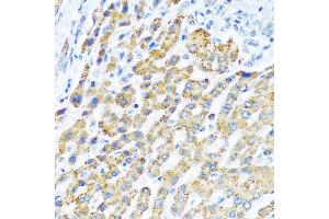 Immunohistochemistry of paraffin-embedded human liver using LRPPRC antibody at dilution of 1:100 (40x lens). (LRPPRC anticorps)
