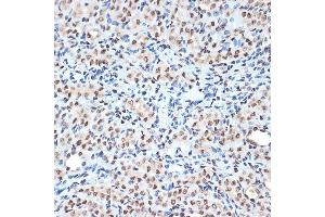 Immunohistochemistry of paraffin-embedded mouse kidney using Histone H2A Rabbit mAb (ABIN7267703) at dilution of 1:100 (40x lens).