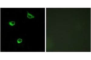 Immunofluorescence (IF) image for anti-Frizzled Family Receptor 6 (FZD6) (AA 121-170) antibody (ABIN2890782) (FZD6 anticorps  (AA 121-170))