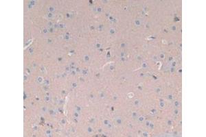 Figure. (SYN1 anticorps  (AA 113-420))