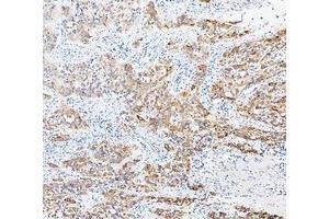 IHC analysis of Cytokeratin 20/Krt20 using anti-Cytokeratin 20/Krt20 antibody (ABIN7601133). (KRT20 anticorps  (AA 29-431))