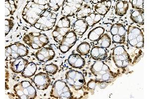 ABIN6256824 and ABIN6273425 at 1/100 staining Rat stomach tissue by IHC-P.