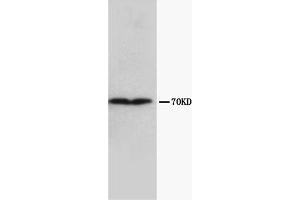 Western Blotting (WB) image for anti-Collagen, Type III, alpha 1 (COL3A1) (Chain alpha 1) antibody (ABIN1106750) (COL3A1 anticorps  (Chain alpha 1))