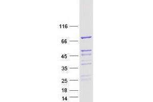 Validation with Western Blot