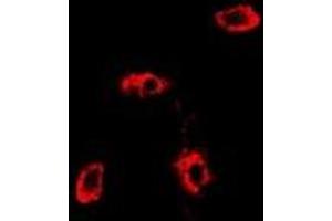 Immunofluorescent analysis of RAB11A staining in MCF7 cells. (RAB11A anticorps)