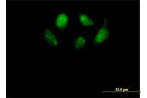 Immunofluorescence of purified MaxPab antibody to SMU1 on HeLa cell. (SMU1 anticorps  (AA 1-513))