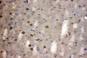 LDHB was detected in paraffin-embedded sections of mouse brain tissues using rabbit anti- LDHB Antigen Affinity purified polyclonal antibody (Catalog # ) at 1 µg/mL. (LDHB anticorps  (AA 237-334))