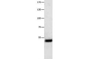 Western Blot analysis of Human liver cancer tissue using EEF1 gamma Polyclonal Antibody at dilution of 1:800 (EEF1G anticorps)
