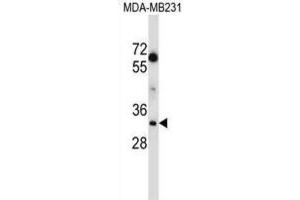 Western Blotting (WB) image for anti-Lactate Dehydrogenase A (LDHA) antibody (ABIN2997387) (Lactate Dehydrogenase A anticorps)