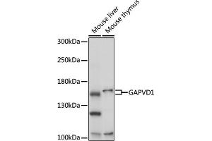 Western blot analysis of extracts of various cell lines, using G antibody (ABIN7267529) at 1:1000 dilution. (GAPVD1 anticorps  (AA 1-260))