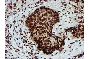 Image no. 9 for anti-Peptidyl Arginine Deiminase, Type IV (PADI4) antibody (ABIN1500017)