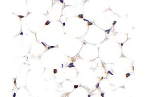 Immunohistochemistry analysis of paraffin-embedded mouse adipose tissue using PPARG Monoclonal Antibody at dilution of 1:1000.