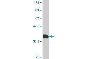 Western Blot detection against Immunogen (34. (CAPZB anticorps  (AA 192-272))