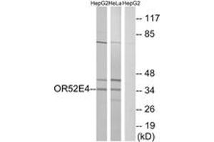 Western Blotting (WB) image for anti-Olfactory Receptor, Family 52, Subfamily E, Member 4 (OR52E4) (AA 200-249) antibody (ABIN2891126) (OR52E4 anticorps  (AA 200-249))