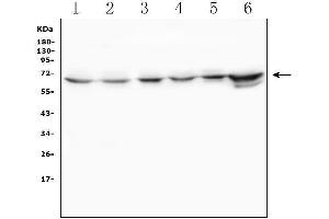 Western blot analysis of TDRD3 using anti-TDRD3 antibody (ABIN6719636).